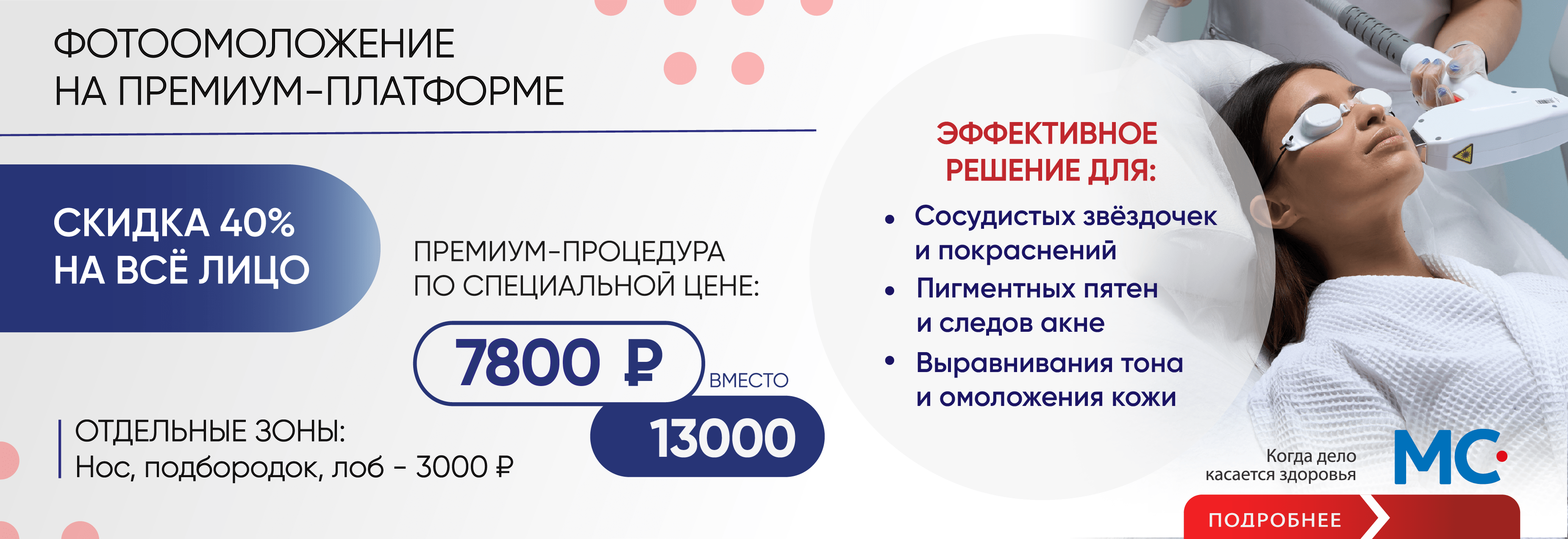 IPL омоложение - 40%